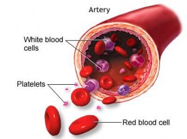 Platelet-Rich Plasma (PRP)