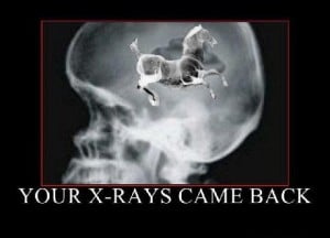 Your Xrays came back